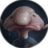 Blobfish